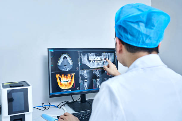 Best Knocked-Out Tooth (Avulsed Tooth) Treatment in Mcswain, CA