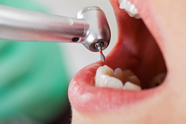 Best 24-Hour Emergency Dental Care in Mcswain, CA